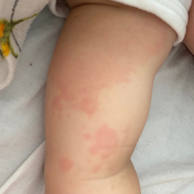 Aptamil De Sorun Var