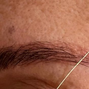 Ema Aydın Kaş İle Mi Sonrası Kırmızı Lekeler