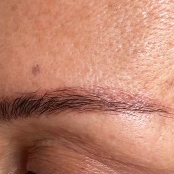 Ema Aydın Kaş İle Mi Sonrası Kırmızı Lekeler