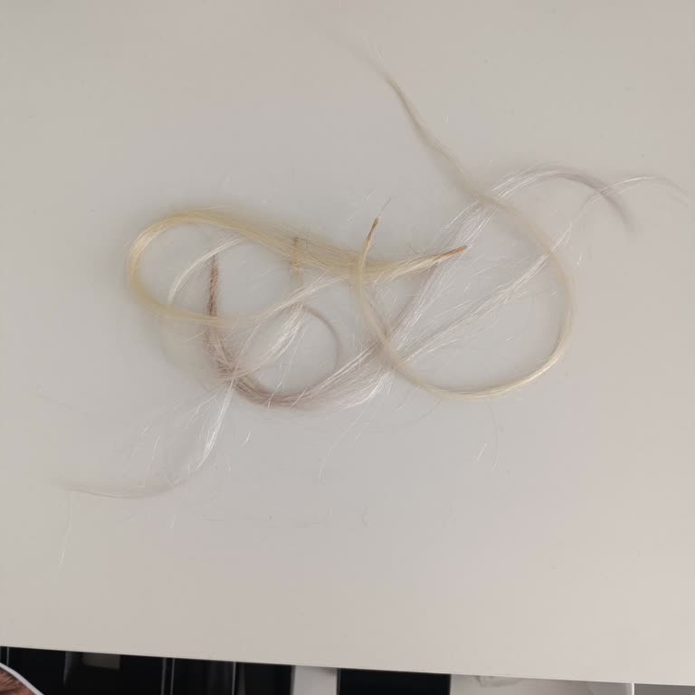 Ordu Mikrokaynak Ombre 52 Instagram Hesabının Haksız Kazancı!