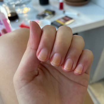 Из-за лака для ногтей Flormar мои ногти пожелтели