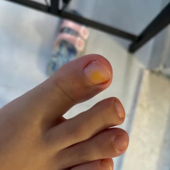 Из-за лака для ногтей Flormar мои ногти пожелтели