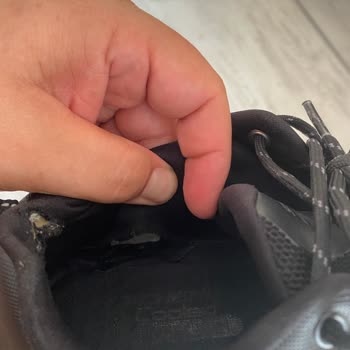 41 Burda AVM SuperStep Skechers Garanti Sorunu