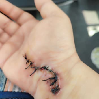 Mustafa Kirazoğlu Devlet Hastanesi Hastanede Çalışan Bir Tanıdığın Yoksa Sıra Alınamaz