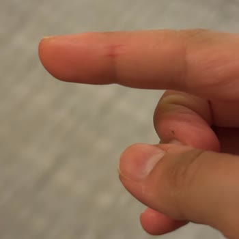 Luis Bien (luisbien.com) Serumun Kapağı/ Şişesi Açılma Esnasında Parmağımı Kesiyor