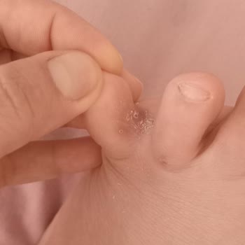 Deichmann Firmasının Ürününden Şikayetçiyim