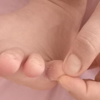 Deichmann Firmasının Ürününden Şikayetçiyim