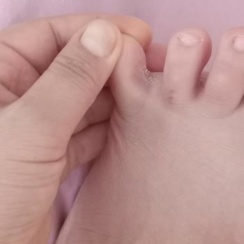 Deichmann Firmasının Ürününden Şikayetçiyim