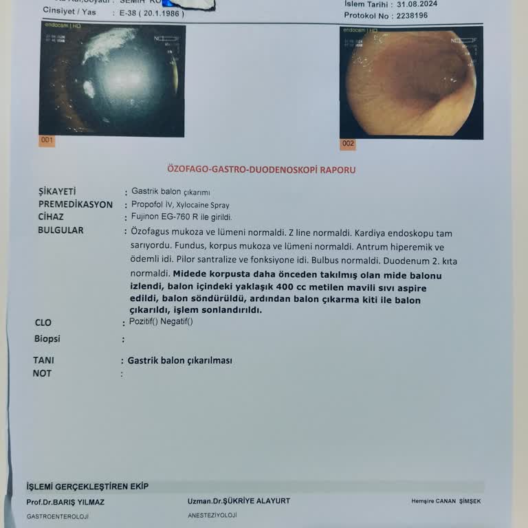 Anadolu Hastaneleri Balon Takma İşlemi