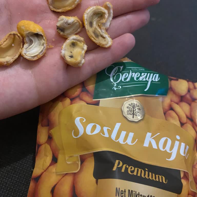 Çerezya Çürük Kaju Ve Sağlık Tehdidi