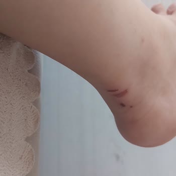 Lumberjack-turkiye.com FLO'dan Aldığım Ayakkabı Ayaklarımı Mahvetti