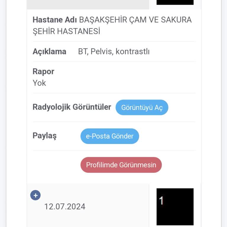 Çam Sakura Şehir Hastanesi Çam Ve Sakura Hastanesi Bt Sonucu