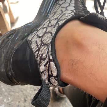 Bigbang Vip Hatalı Dikim Ve Dayanıksız Ürün Sorunu