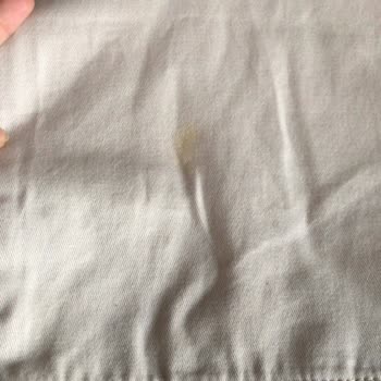 Zincirwear Defolu Ve Kirli Ürün Gönderimi, İlgisizlik Ve Ekstra Kargo Ücreti