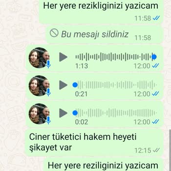 Mamajoo Sut Sağma Makinesi Küflü Süt İçirmişim Ürün Hatalı Bir Ürün