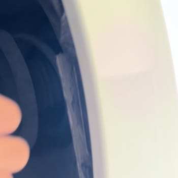 Renault Reno Servisinde Kötü İşçilik Ve Hatalı Parçalar