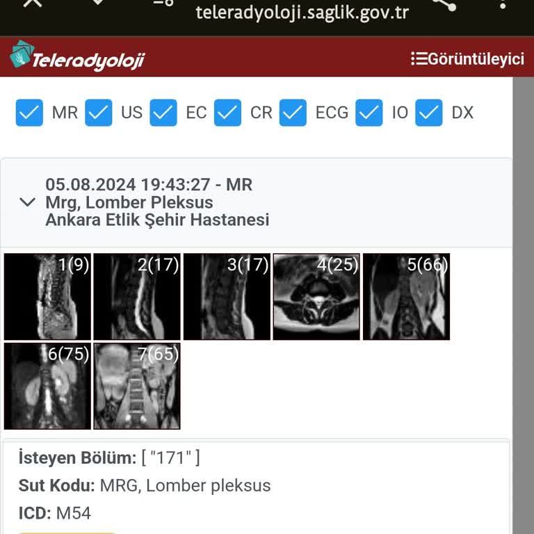 Ankara Etlik Şehir Hastanesi 1 Ay Oldu MR Raporum Çıkmadı