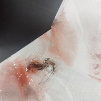 BİM Marketten Aldığım Reçelde Hijyen Sorunu