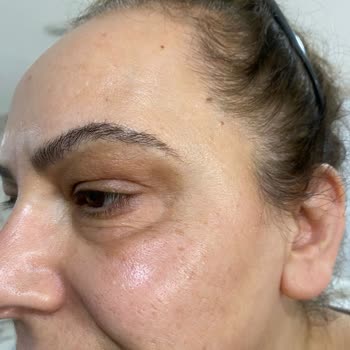 Awera Güzellik Ve Estetik Şüpheli Hizmet Ve Personel Yetersizliği