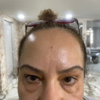 Awera Güzellik Ve Estetik Şüpheli Hizmet Ve Personel Yetersizliği