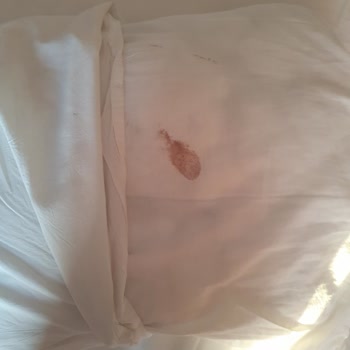 Tatilbudur Ve Royal Beach Clup Otel Mağduriyeti