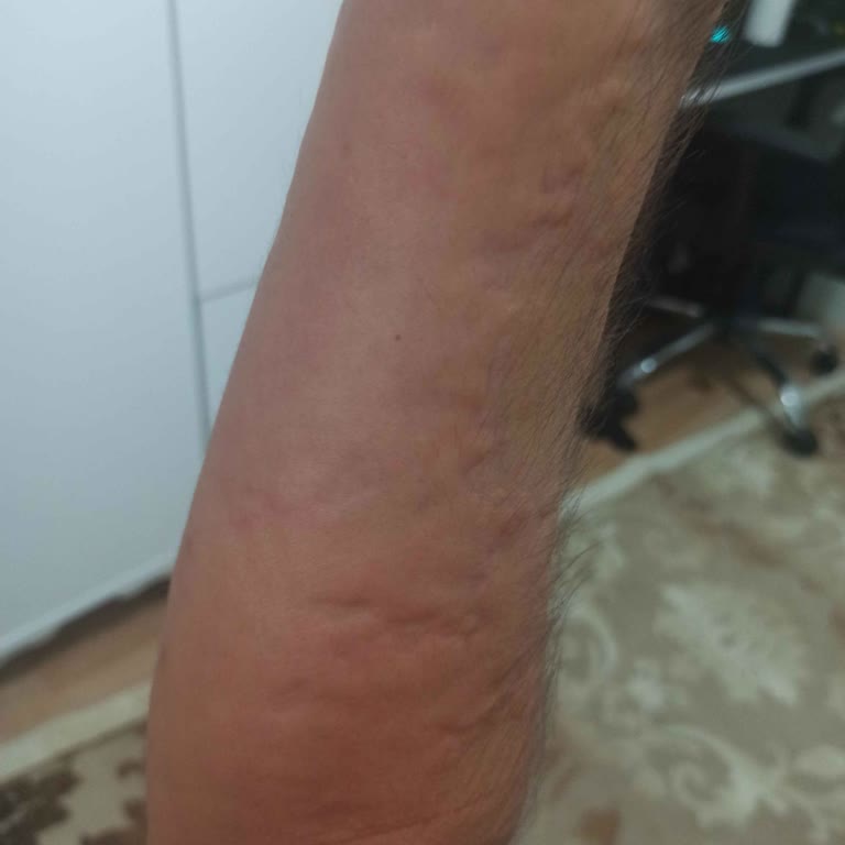 Le Petit Marseillais Ekstra Alerji Etkisi