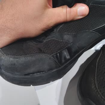 Skechers Spor Ayakkabı Ürün Kalitesizliği.