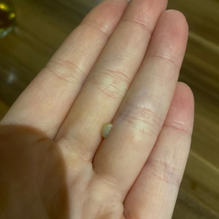 Snickers İçinden Farklı Bir Şey Çıktı