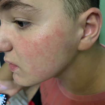 Garnier İnanılmaz Boyutta Alerjik