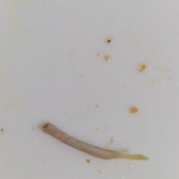 Erpiliç İçinden Çıkan Kemik