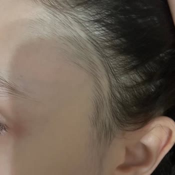 Nish Esthetic Yanlış Uygulama Ve Kötü Müşteri Hizmeti Deneyimi