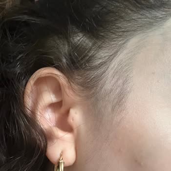 Nish Esthetic Yanlış Uygulama Ve Kötü Müşteri Hizmeti Deneyimi