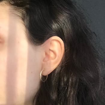 Nish Esthetic Yanlış Uygulama Ve Kötü Müşteri Hizmeti Deneyimi