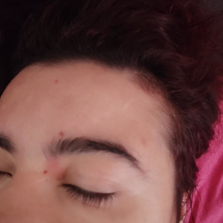 Sinoz Serum Ve Güneş Kremi Yüzümü Mahvetti