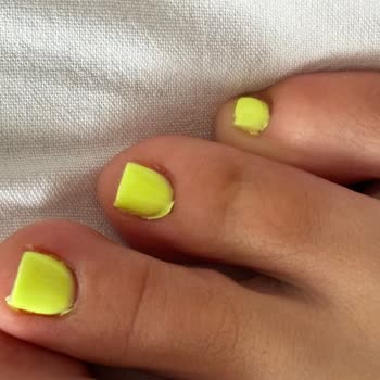 Hamide Gür Beauty Center İşletme Sahibi Yapılan Kötü İşlemi Kabullenmiyor Bile