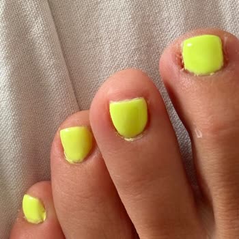 Hamide Gür Beauty Center İşletme Sahibi Yapılan Kötü İşlemi Kabullenmiyor Bile