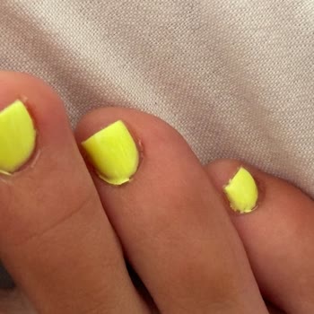 Hamide Gür Beauty Center İşletme Sahibi Yapılan Kötü İşlemi Kabullenmiyor Bile