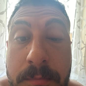 Orange County Kemer Havuzdan Kaptığım Aşırı Bulaşıcı Mikrop