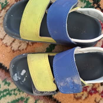 Vicco Çocuğumun Ayağını Yaralayan Sandalet