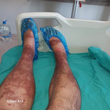 Sağlık Bakanlığı Antalya İl Sağlık Müd. İlgisiz