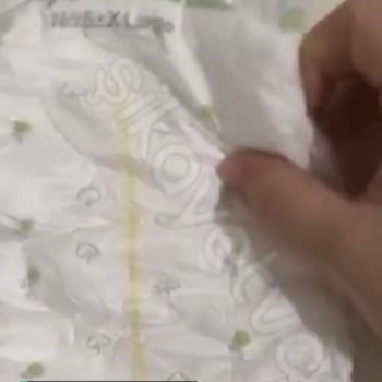 Sleepy Bezin Ön Kısmında İçinde Sakız Gibi Yumuşak Bir Şey Var!