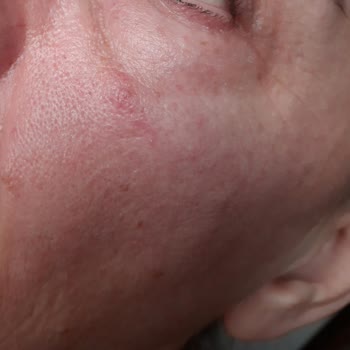 Loreal Paris Hyaluron Uzmanı Kremleri