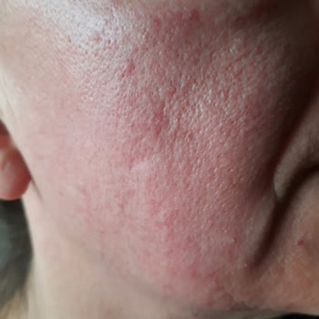 Loreal Paris Hyaluron Uzmanı Kremleri