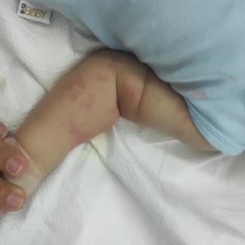 Sma Comfort 1 Numara Alerji