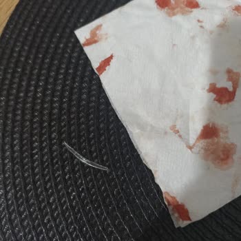 BİM Yurdum Közlenmiş Patlıcandan Cam Çıktı