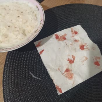 BİM Yurdum Közlenmiş Patlıcandan Cam Çıktı