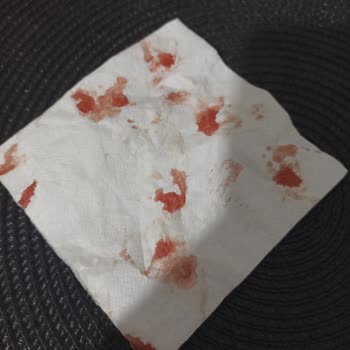 BİM Yurdum Közlenmiş Patlıcandan Cam Çıktı