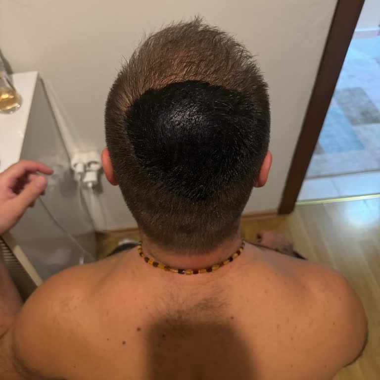 Batçı Hair Atelier Saç Sıkılaştırıcı Ürünle İlgili Olumsuz Deneyim