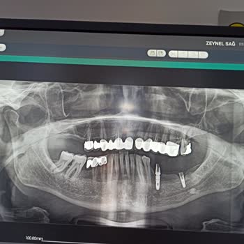 Osstem Implant Osstem İmplant Hakkında