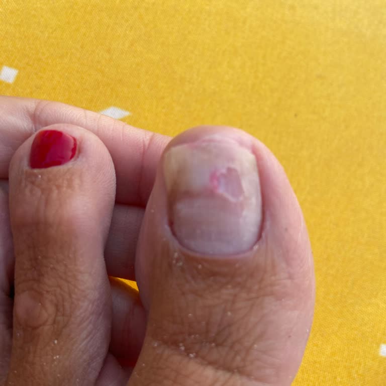 Selin Beauty Center Pedikür Sonrası Tırnaklarımda Ağrı Ve Hasar